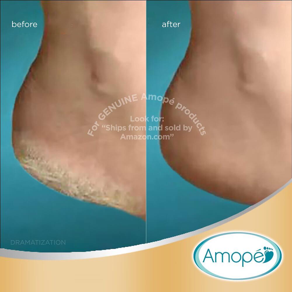 amope pedi perfect before and after